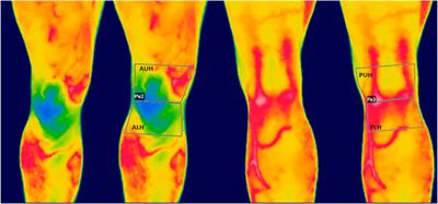 The influence of static and dynamic warm-up on knee temperature: infrared thermography insights before and after a change of direction exercise